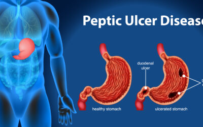 Peptic Ulcer disease